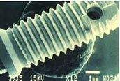 Dental Implant