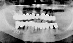 Radiograph