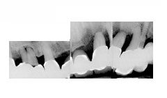 Xray
