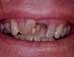Preop closeup