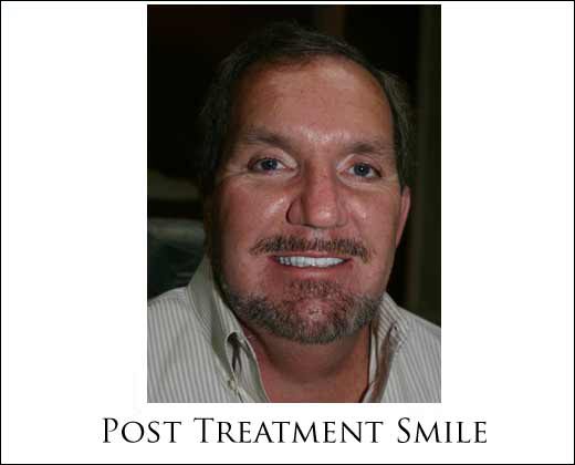 PostopSmilingPatient