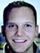 Zygomatic implant treatment for congenitally missing teeth