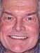 Traditional Two-Stage Dental Implant Reconstruction for Upper Teeth