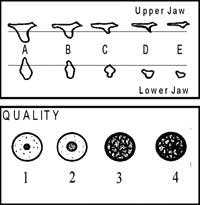 Illustration of bone quantity and bone quality