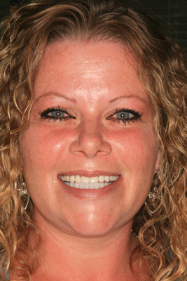 Smiling dental patient