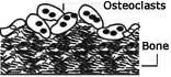 Osteoclasts