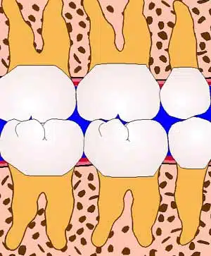 Bone picture