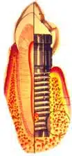 Image of Implant and bone on Bone Quantity and Quality Web Page